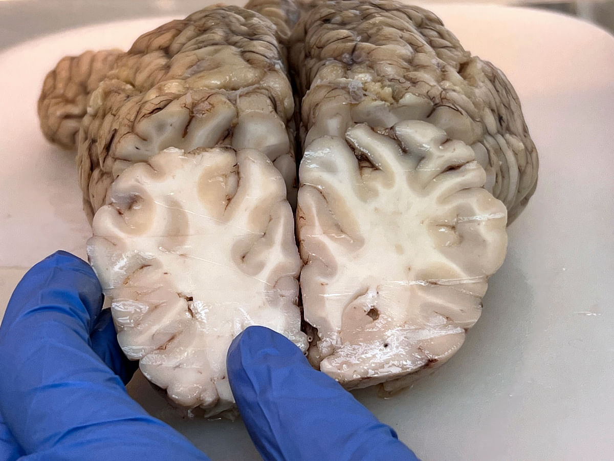 Hevosen aivot otsan puolelta katsottuna. Aivojen etuosasta on viilletty sentin paksuinen siivu poikittaissuunnassa. Kuvassa näkyy selvästi harmaa aine, aivokuori eli korteksi,  joka on hermosoluja,  ja valkea aine, joka koostuu rasvamaisesta myeliinistä ja hermojen johtoradoista.
