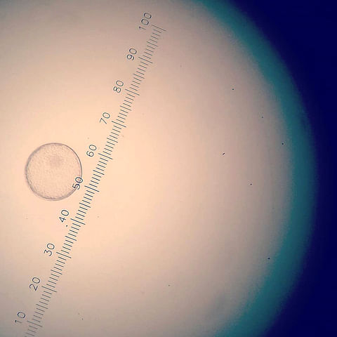 Alkion näkee paljaalla silmälläkin, mutta tässä Isa Hallmanin Hollannissa huuhtelema alkio mikroskoopin alla tarkasteltavana ennen siirtoa vastaanottajatammaan. 